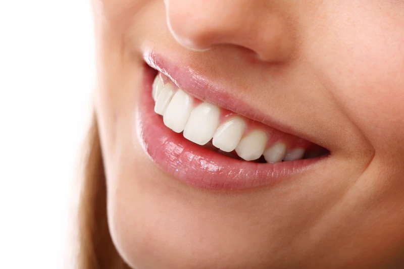 Isabel Barro clinica dental en Alicante